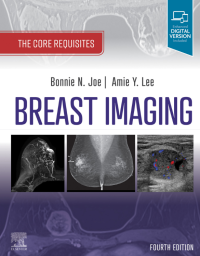 Image of Breast Imaging