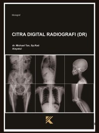 Image of Citra Digital Radiografi